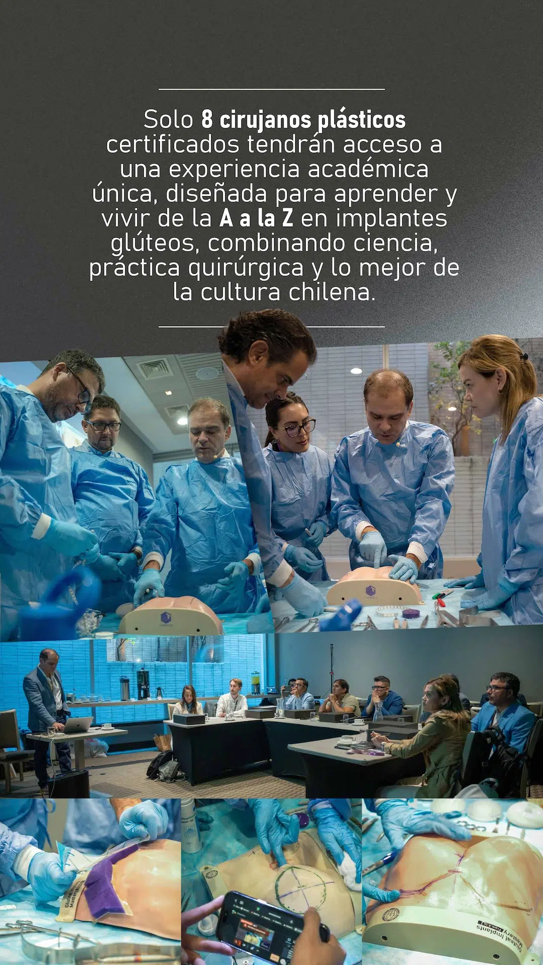 Gluteal Implants by Dr Patricio Covarrubias